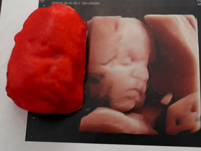 Nikki  Aylward with  newborn baby Hannah and the 3D moulds of the scan before she was born.Pic Jamie Hanson