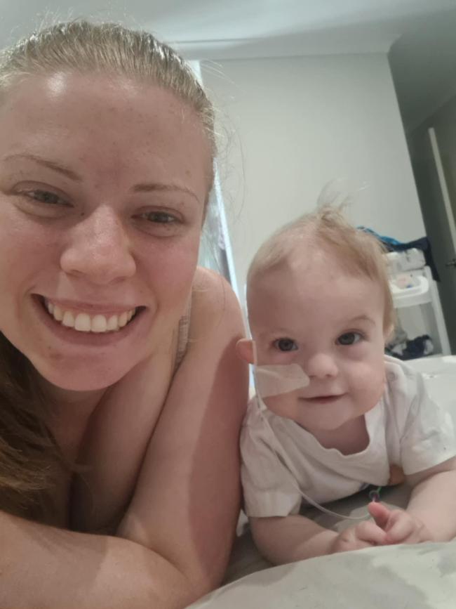 Luca has endured eight surgeries. Picture: Supplied