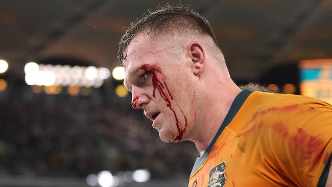 Angus Bell of the Wallabies had hit head cut open against South Africa. (Photo by Paul Kane/Getty Images)