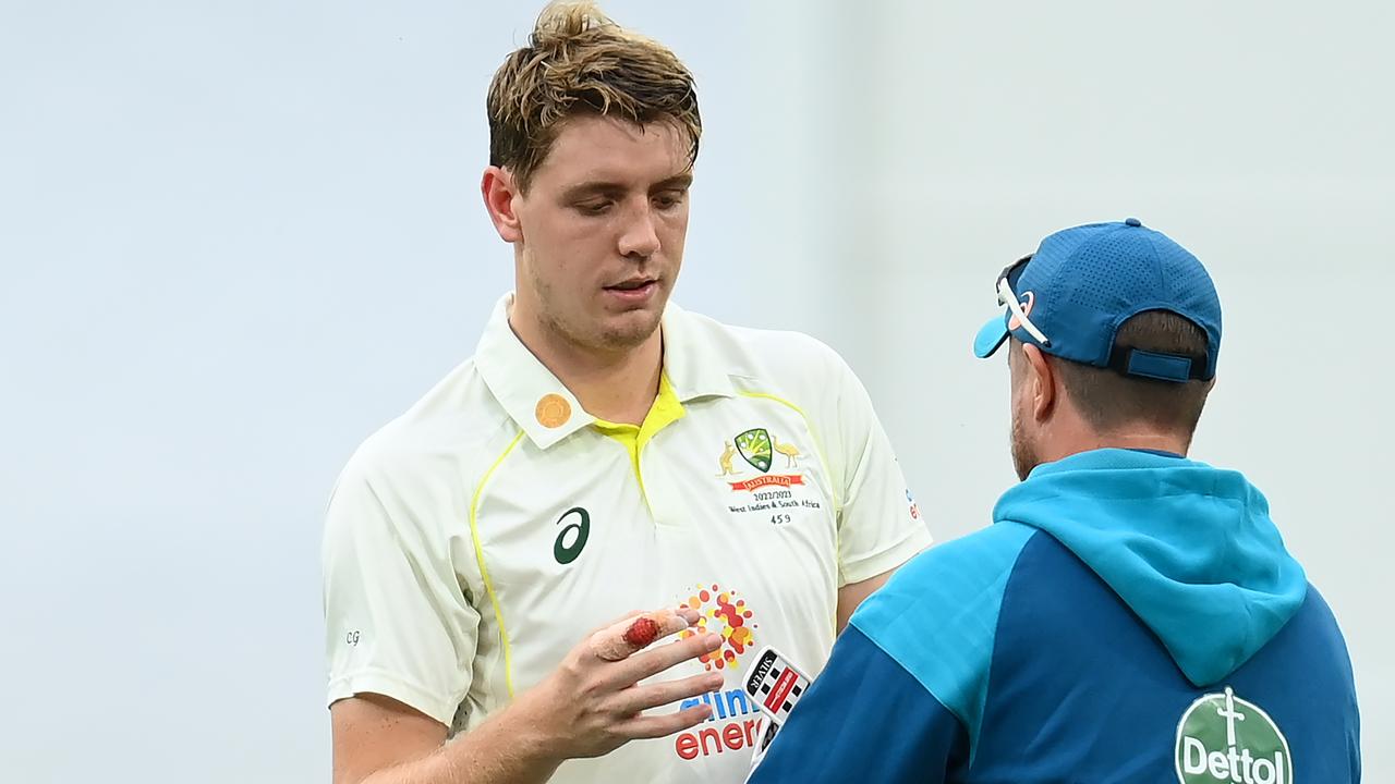 Cameron Green of Australia has his finger checked . (Photo by Quinn Rooney/Getty Images)