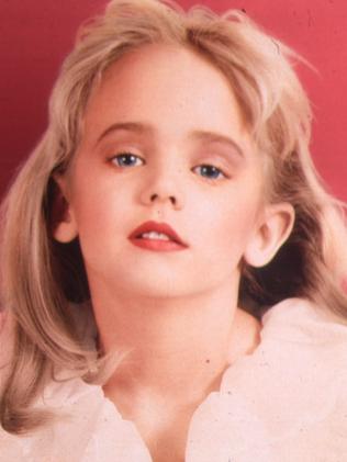 JonBenet Ramsey.