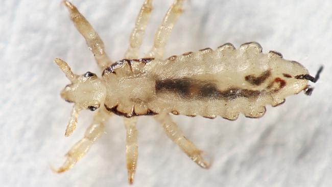 Head lice treatments don’t work anymore: study | Daily Telegraph