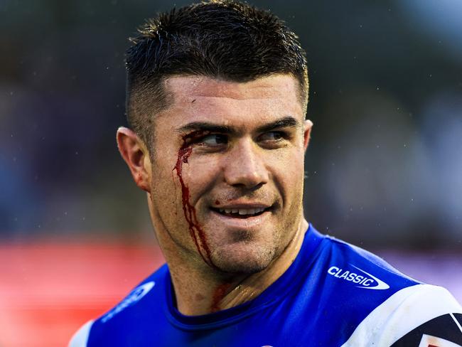 TAMWORTH, AUSTRALIA - MAY 11: Bradman Best of the Knights sporting a cut eye smiles after victory during the round 10 NRL match between Wests Tigers and Newcastle Knights at Scully Park, on May 11, 2024, in Tamworth, Australia. (Photo by Mark Evans/Getty Images)