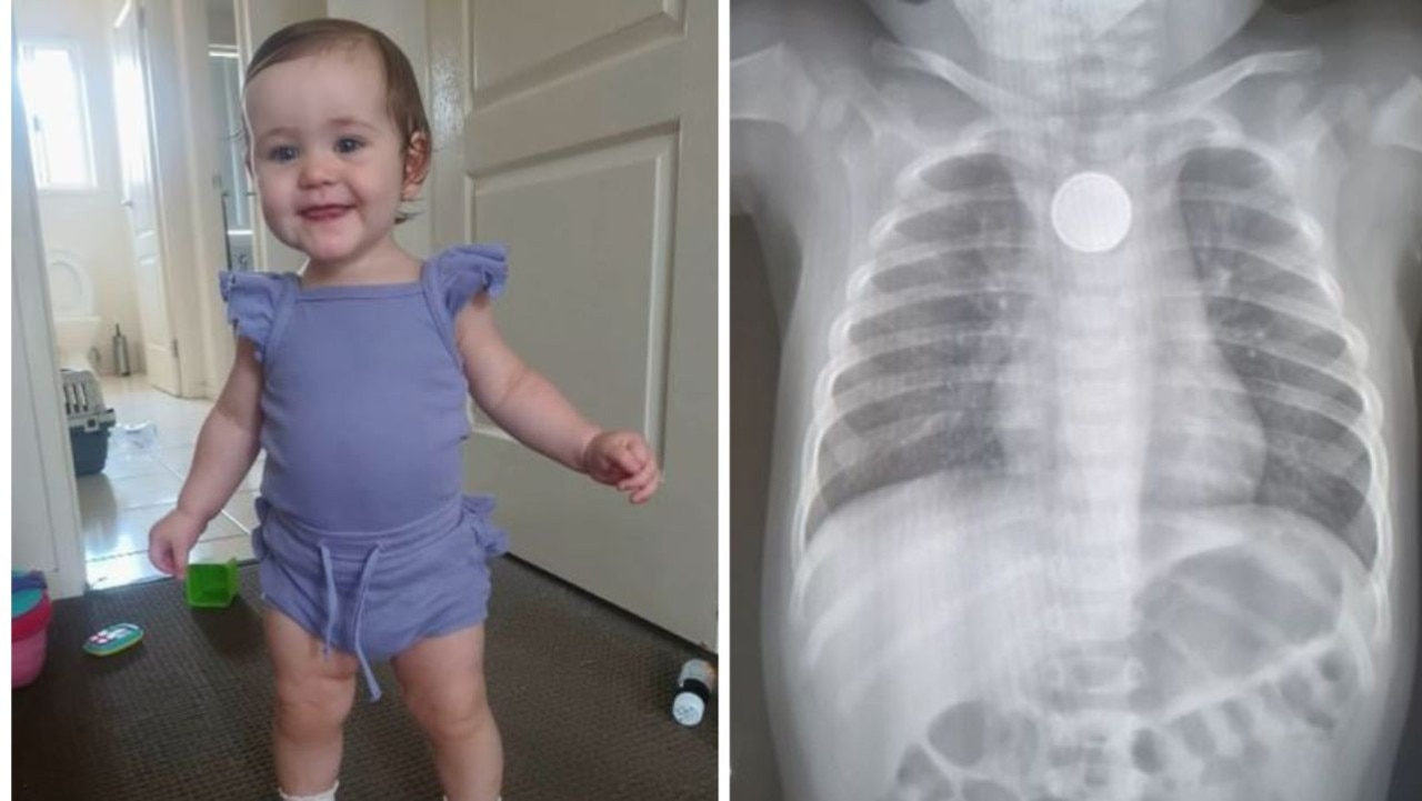 Amity swallowed a button battery but was sent home from hospital. Picture: 7 News