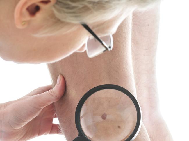 Dermatologist examines a mole of male patient