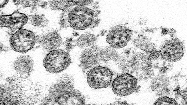 New York City health authorities have issued an alert to doctors about a severe inflammatory condition possibly linked with COVID-19 found in a cluster of US children after first being reported in Europe. Picture: AP