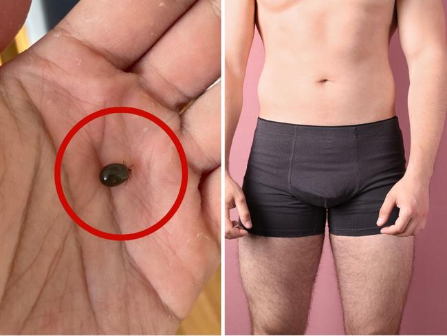 ‘Bloodsucker’: Horror find in bloke’s undies