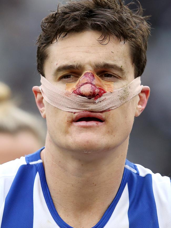 It was a bloody horrible day for Scott Thompson and the Kangas. Pic: Michael Klein