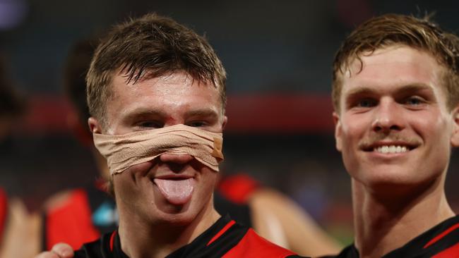 Jye Menzie with a taped up nose after the Dons win over the Roos. Picture: Michael Klein