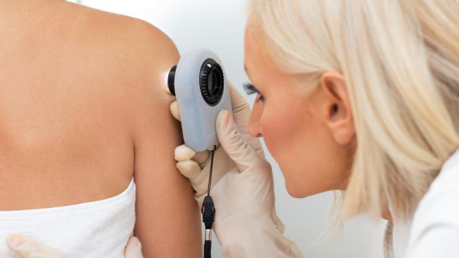 Toowoomba is above average for rates of melanoma. 