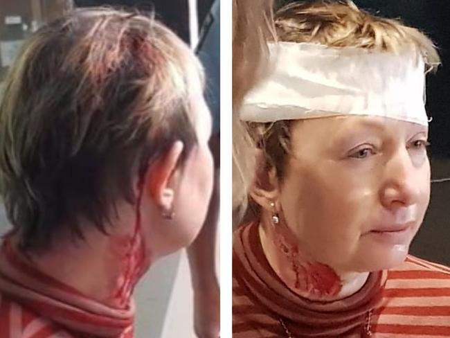 A woman has suffered head wounds from a metal projectile at a Ukrainian protest outside the German embassy in Sydney on April 26, around 12:55pm.