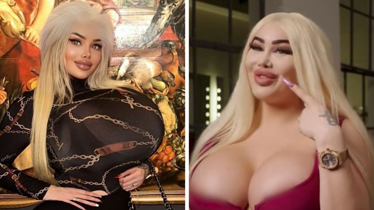 Woman spends $333K on plastic surgery