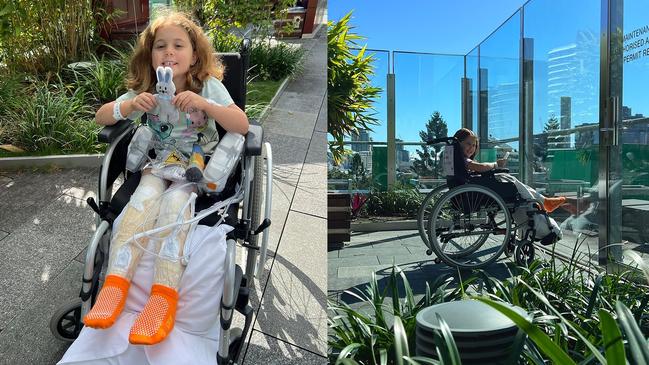 Little Marlow Thurston has a long road to recovery after she sustained significant burns to her legs after a backyard bonfire exploded at her Byfield home.