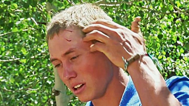 A teen staffer at a US Colorado camp, who gave only his first name, Dylan, describes how he fought off a bear after waking up to find the animal biting his head and trying to drag him away on Sunday, July 9, 2017. Picture: KMGH-TV via AP.