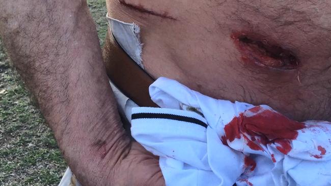 One tourist suffered severe cuts to his stomach. Picture: Facebook