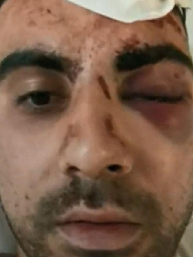 Daniel, 25, was assaulted on Saturday outside the MCG. Picture: Channel 9