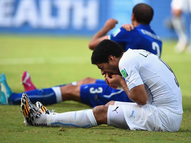 Luis Suarez appears to have hurt his teeth, somehow...