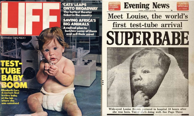 Early IVF headlines.