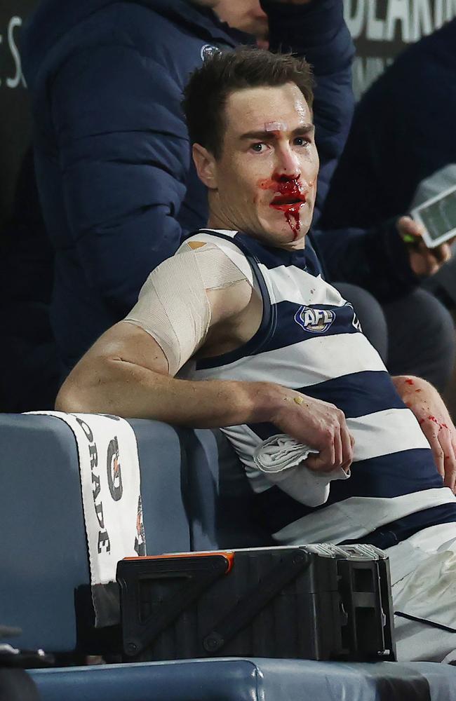 Geelong’s Jeremy Cameron nurses a bloody face after copping an accidental elbow during the round 18 AFL match against Essendon. Picture: Michael Klein