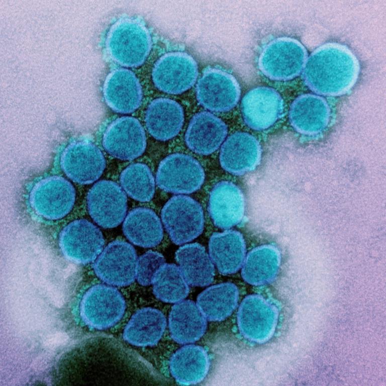A new strain of Covid has been detected in the US. Picture: NIAID/Alamy