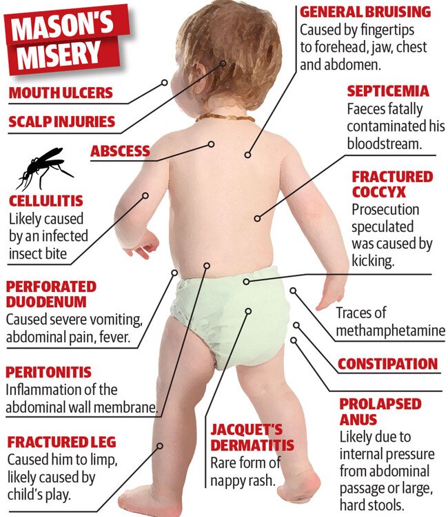 A graphic depicting the horrible injuries Mason Lee suffered.