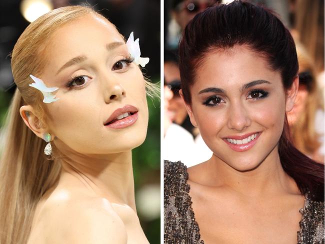 Ariana Grande has been accused of having multiple cosmetic procedures.