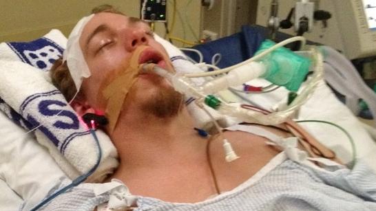 Jason Lindsley, 24, on life-support in an induced coma after being allegedly hit by another man in an assault incident at Zhivago nightclub on Sunday night. He suffered a fractured skull and swelling to his brain. This is an image of him in an induced coma at Royal Adelaide Hospital. Image taken by father. Picture: Facebook