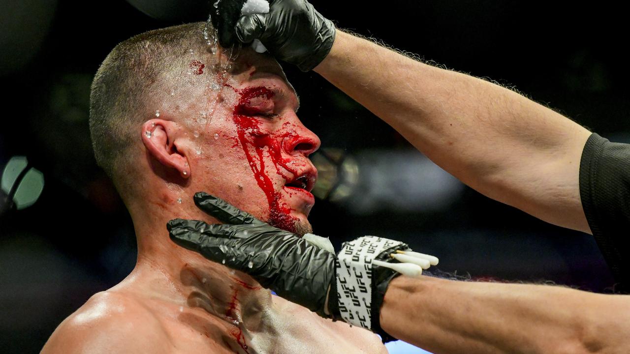 Nate Diaz was in the wars on Sunday.
