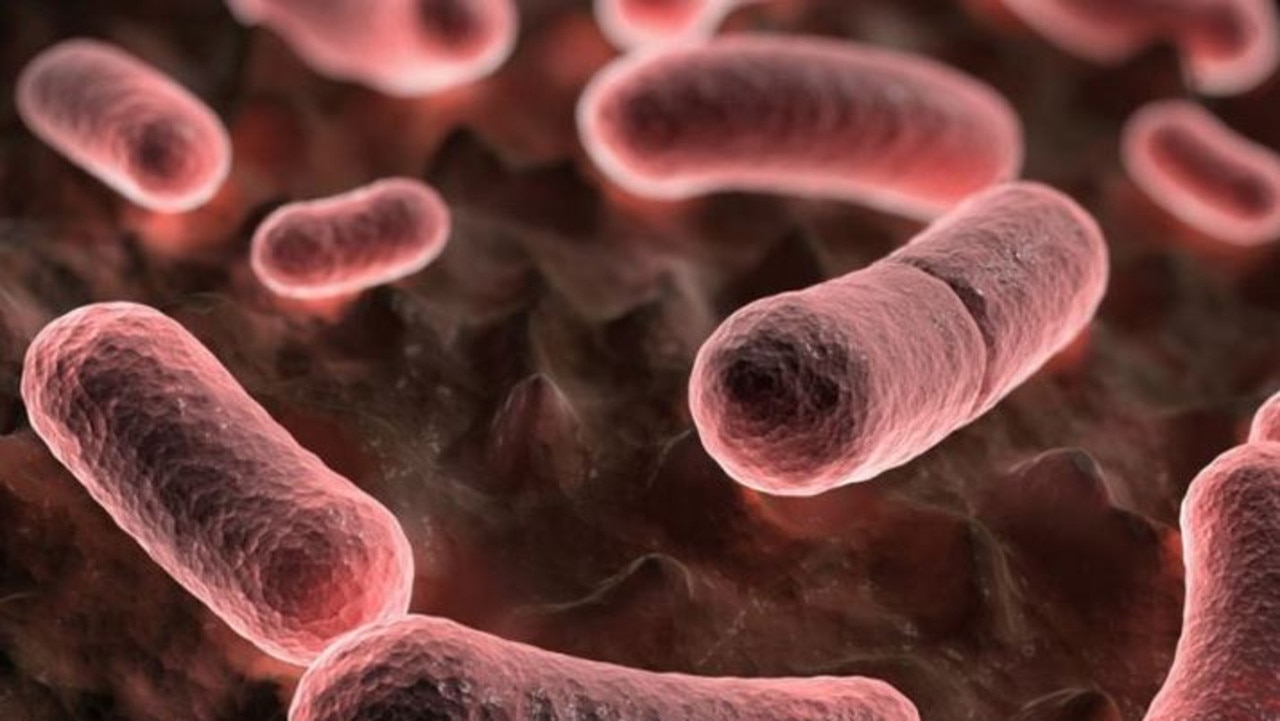 Bubonic Plague 2025 California Institute