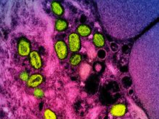 (FILES) This undated image obtained from the National Institute of Allergy and Infectious Diseases (NIAID) in Bethesda, Maryland, shows a colorized transmission electron micrograph of monkeypox particles (green) found within an infected cell (pink and purple), cultured in the laboratory. The World Health Organization on May 11, 2023, has declared that mpox no longer constitutes a global health emergency , almost exactly a year after the disease formerly known as monkeypox started spreading globally. WHO chief Tedros Adhanom Ghebreyesus said the decision was prompted by falling case numbers worldwide, but emphasised that the disease remains a threat, particularly in areas of Africa where it has long been present. (Photo by Handout / National Institute of Allergy and Infectious Diseases / AFP) / RESTRICTED TO EDITORIAL USE - MANDATORY CREDIT 