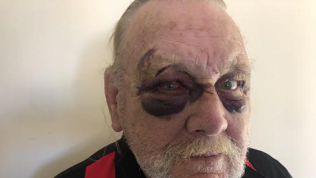 Barry Lee was robbed and bashed by thugs at his home in Raymond Terrace.