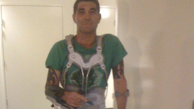 A badly injured Rudland in the months after the crash.
