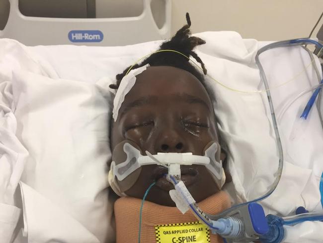 Leon was placed in an induced coma after suffering facial and head injuries, a cracked skull and severe brain trauma. Picture: Supplied