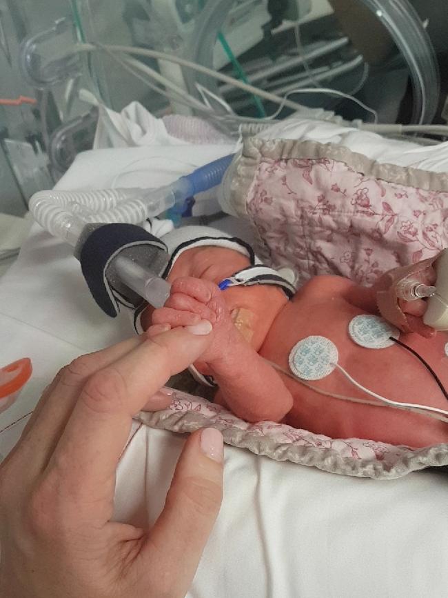 Mairead Mangan’s daughter Darcey was born 10 weeks premature.