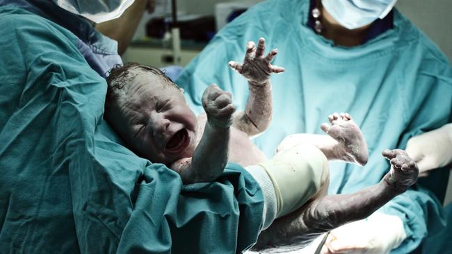 An early delivery can be fatal to babies born with underdeveloped organs. Generic picture