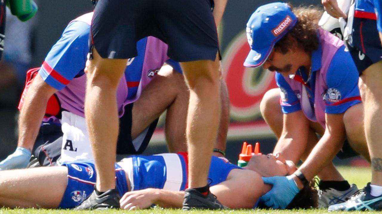 Western Bulldogs’ Liam Picken has suffered a few concussions in recent years.