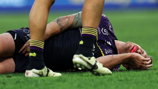 Cameron Munster of the Storm lays injured on the ground. (Photo by Hannah Peters/Getty Images)