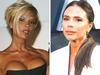 Posh reveals big plastic surgery regret