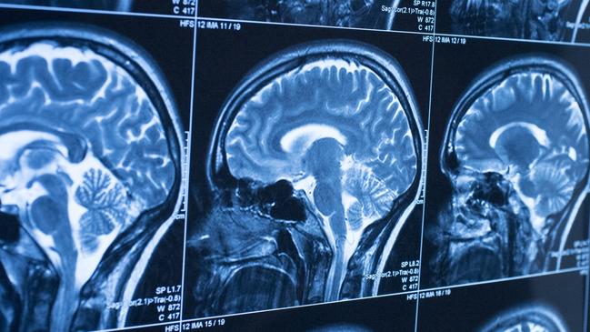 DEAL 16 AUG 2019Brain science Pic : iStock