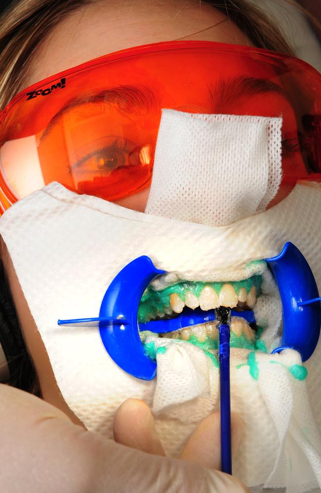 Dentists offer many teeth-whitening options. Picture: Chris Pavlich