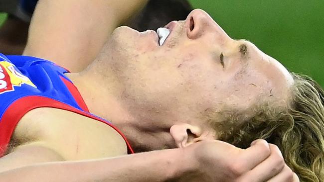 MELBOURNE, AUSTRALIA - JULY 04: Aaron Naughton of the Bulldogs lays on the ground concussed during the round 16 AFL match between Western Bulldogs and North Melbourne Kangaroos at Marvel Stadium on July 04, 2021 in Melbourne, Australia. (Photo by Quinn Rooney/Getty Images)