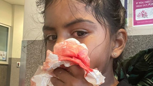 The mother of a two-year-old girl who suffered tooth damage at a childcare centre at Avoca says the centre failed to provide adequate first aid and did not notify her when the incident occurred.