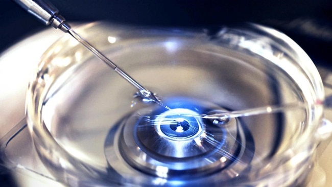 Researchers are trying to improve the IVF process and understand more about early pregnancy. Picture: Getty Images