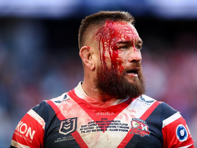 Jared Waerea-Hargreaves needed six stitches.