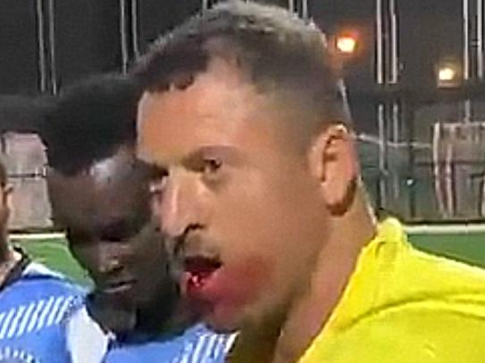 A soccer referee has broken his jaw in a vicious assault at a Sydney match on Friday night., , The official was charged at by a man dressed in black, believed to be a suspended player, who forced him to the ground, then repeatedly punched and kicked him as players and spectators tried to stop the attack. Picture: Supplied