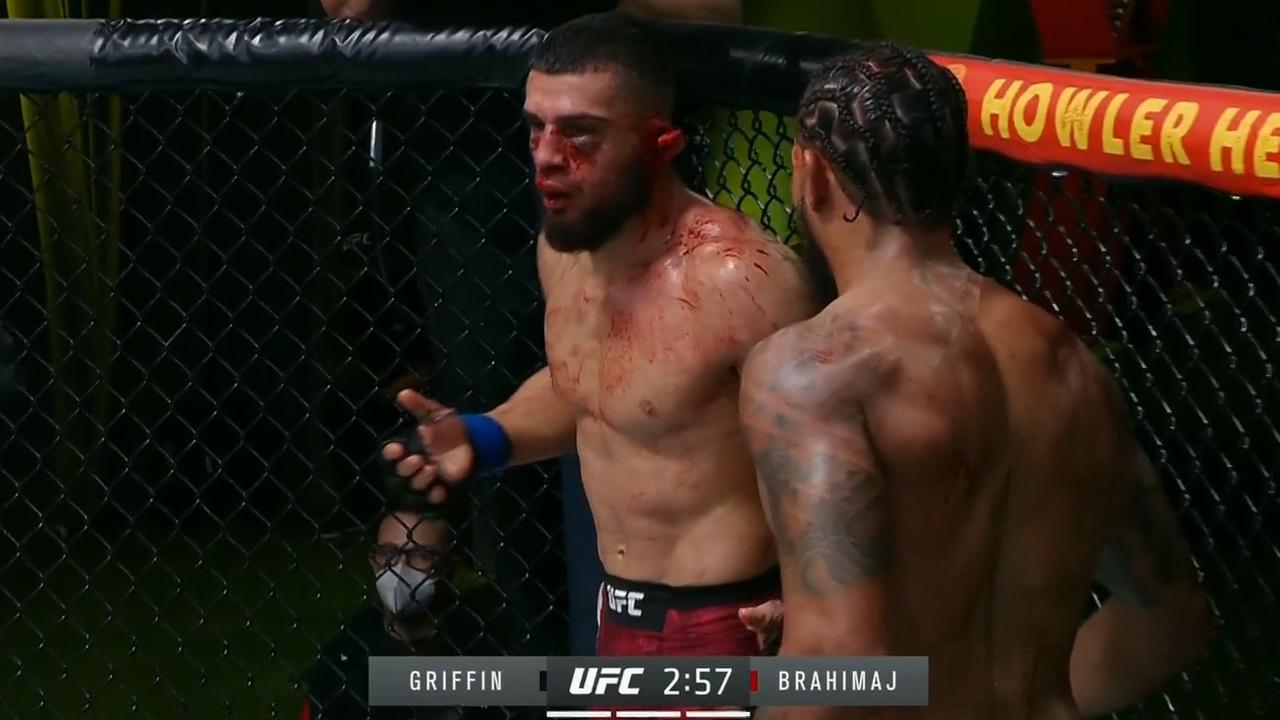 Ramiz Brahimaj nearly lost an ear against Max Griffin.