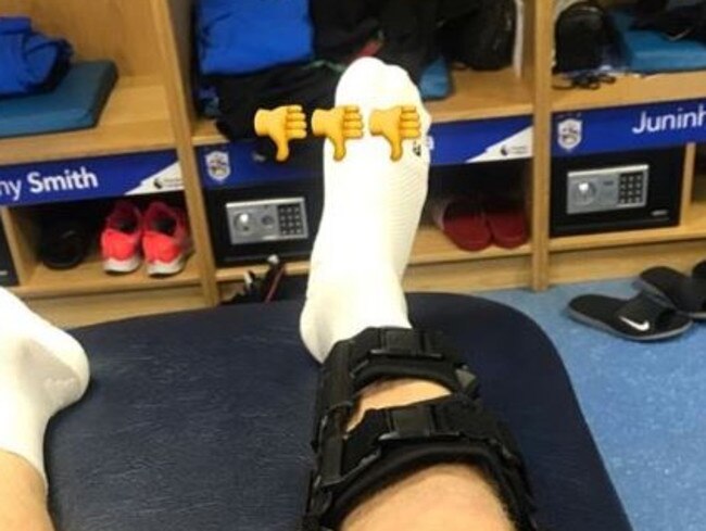 Aaron Mooy's Instagram shot of his injury.