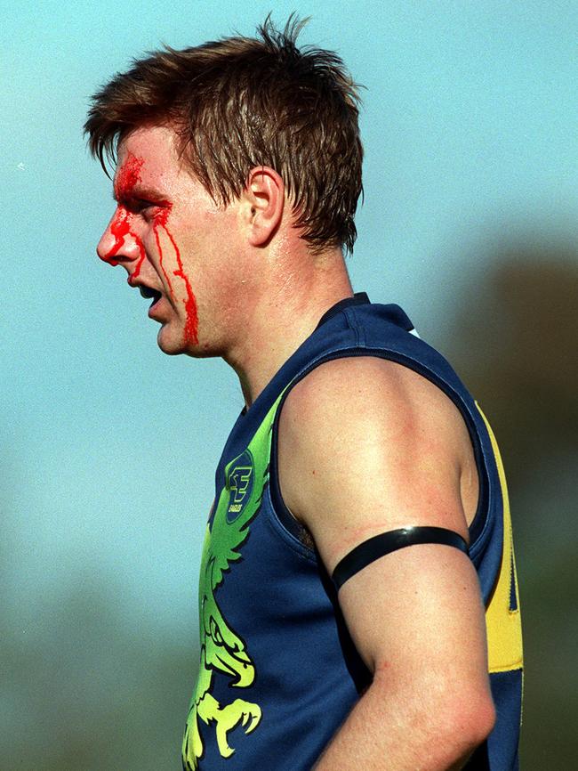 Chad Rintoul after a head knock in the SANFL.