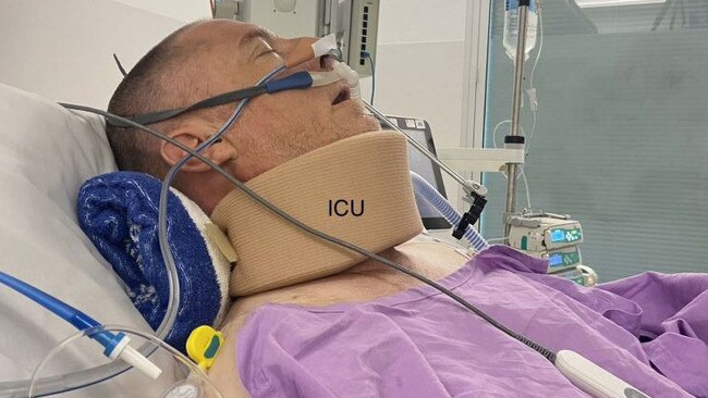 Stephen Gleeson recovering in Gold Coast University Hospital. Picture: supplied