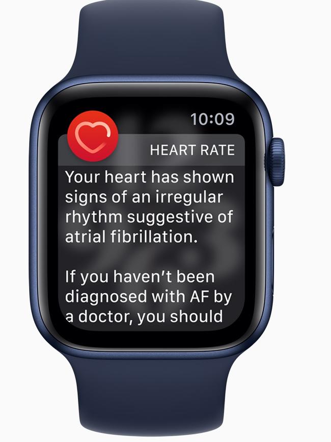 An ECG app and irregular rhythm notification are now available on an Apple Watch.